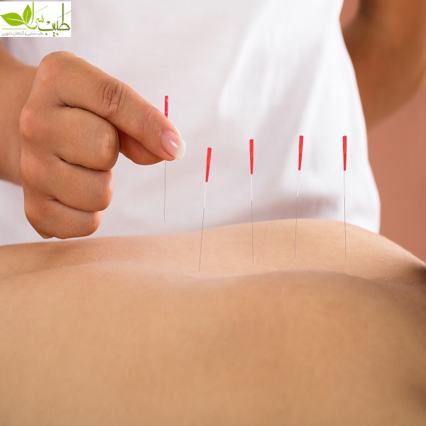 دارو گیاهی تقویت جنسی مردان دارو گیاهی تقویت جنسی مردان